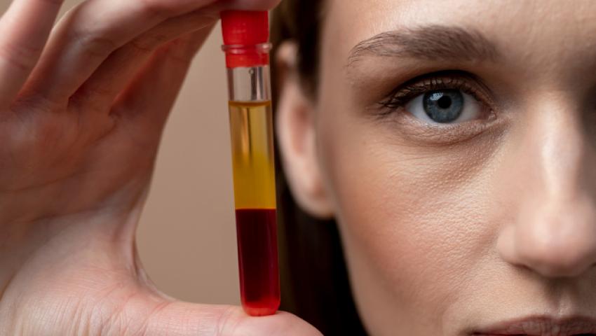 PRP - Platelet Rich Plasma Treatment