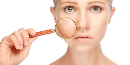Fractional Skin Resurfacing